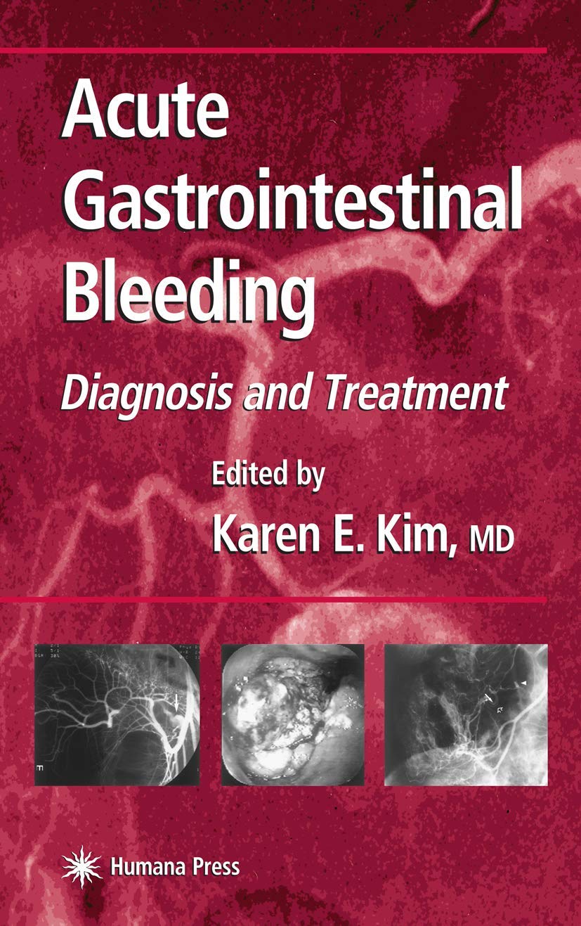 ACUTE
GASTROINTESTINAL
BLEEDING
DIAGNOSIS AND TREATMENT