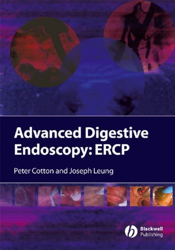 ADVANCED
DIGESTIVE
ENDOSCOPY:
ERCP
