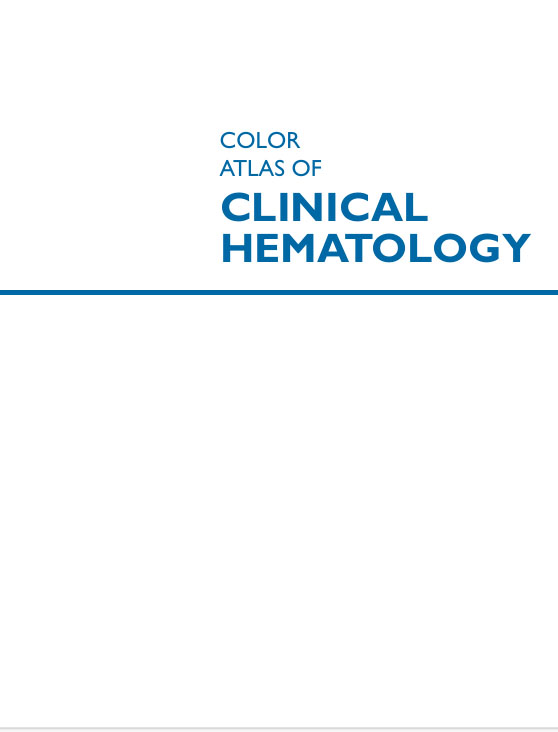 COLOR ATLAS OF CLINICAL HEMATOLOGY