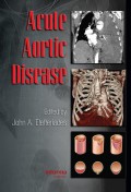 Acute aortic disease