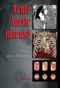 Image of Acute aortic disease