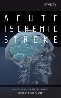 Image of Acute Ischemic Stroke