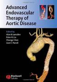 Image of Advanced
Endovascular
Therapy of Aortic
Disease